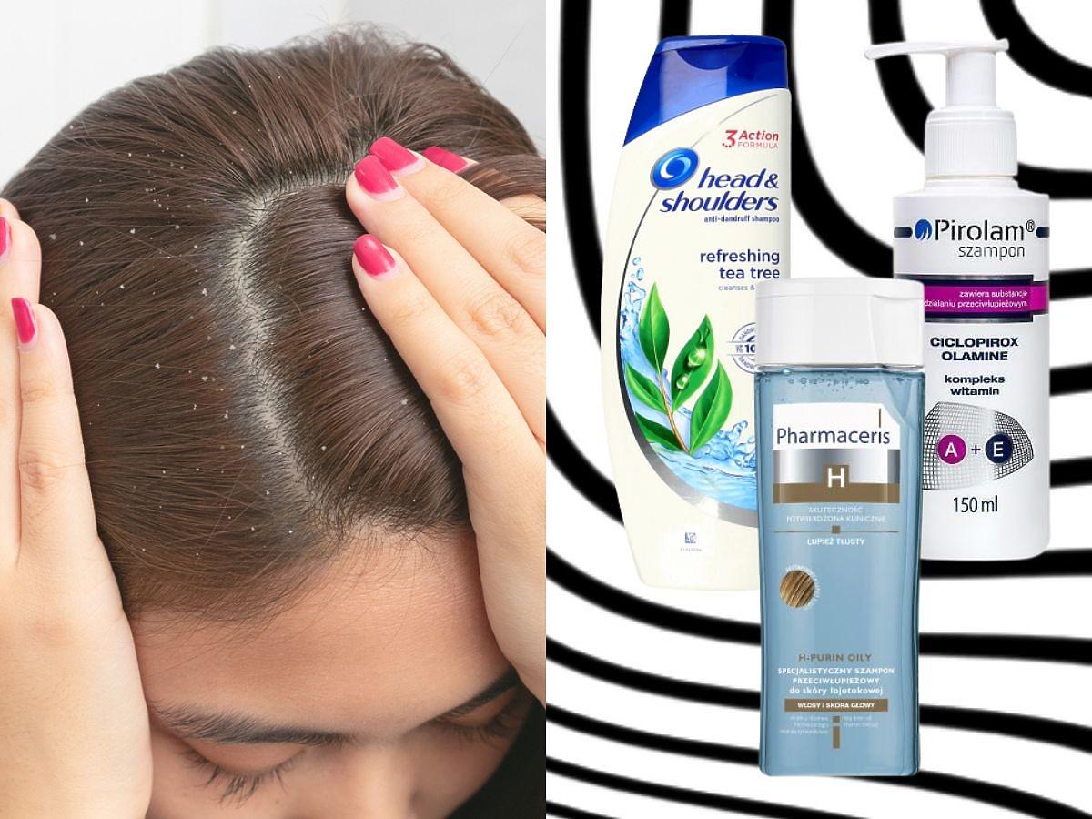 jak długo stosować szampon przeciwłupieżowy
